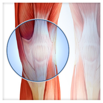Dr. Mead performs mainly three types of knee surgeries depending on the severity of the injury: total knee replacement, partial knee replacement and knee arthroscopy. His minimally invasive techniques, inspired by a quality driven approach, guarantee outstanding results, low revision rates, low infection rates and patients virtually walking immediately.